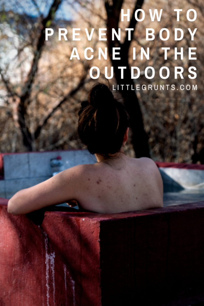 How to Prevent Body Acne in the Outdoors